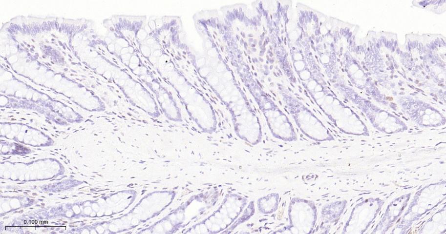 ATP依赖解旋酶SMARCA2重组兔单抗