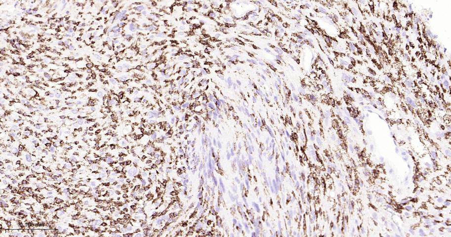 P选择素糖蛋白配体1重组兔单抗