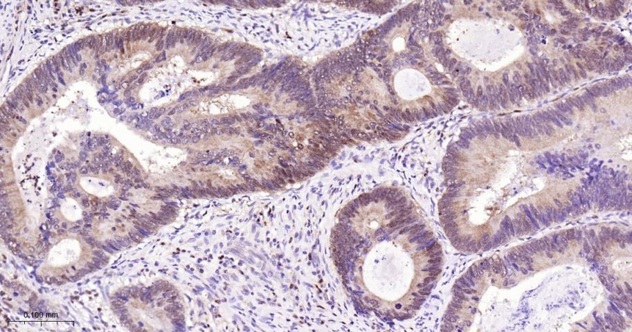 凋亡相关斑点样蛋白ASC重组兔单抗