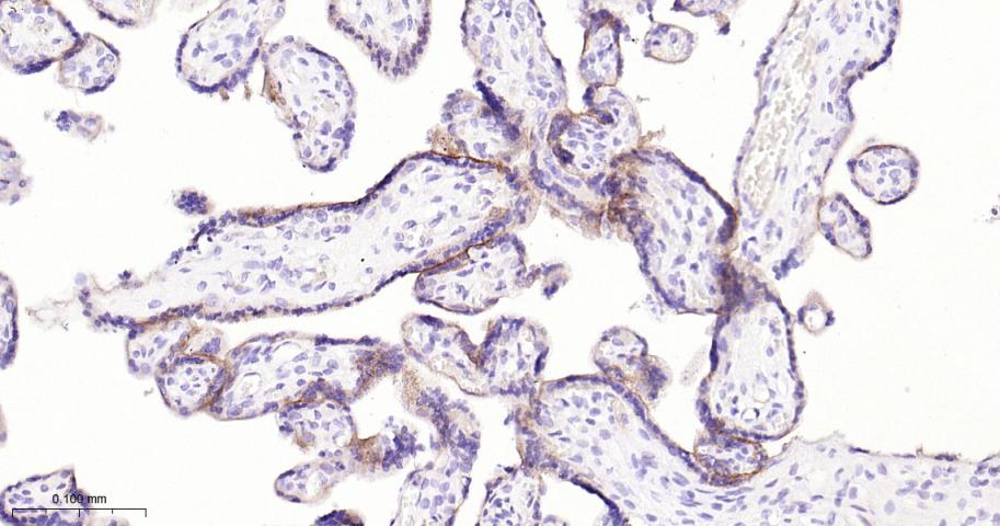 程序性死亡配体1重组兔单抗