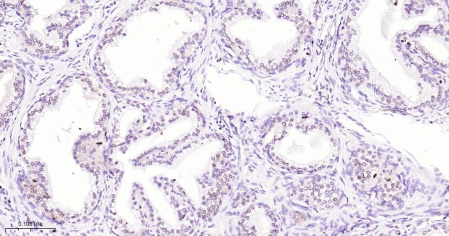转录因子同源蛋白Nkx3.1重组兔单抗
