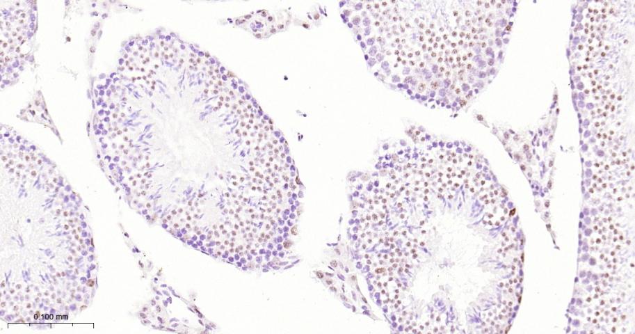 ATP依赖解旋酶SMARCA2重组兔单抗