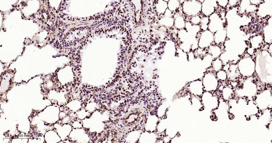 高迁移率族蛋白B1重组兔单抗