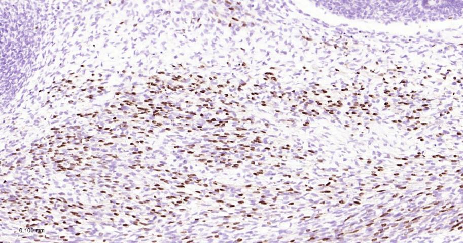 肌细胞生成素重组兔单抗