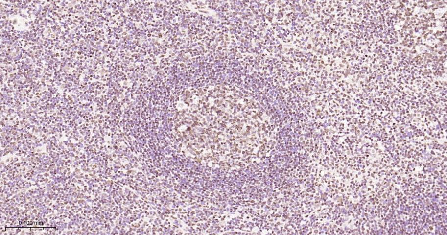 高迁移率族蛋白B1重组兔单抗