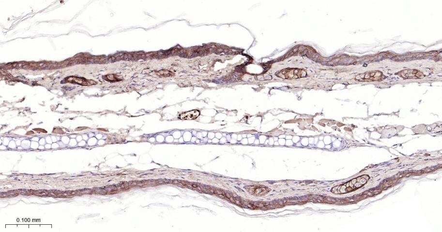 CLDN1 Mouse mAb (一抗) - IHC-P,IHC-F,IF | Bioss