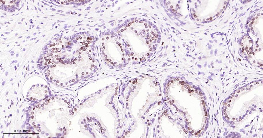 转录因子同源蛋白Nkx3.1重组兔单抗