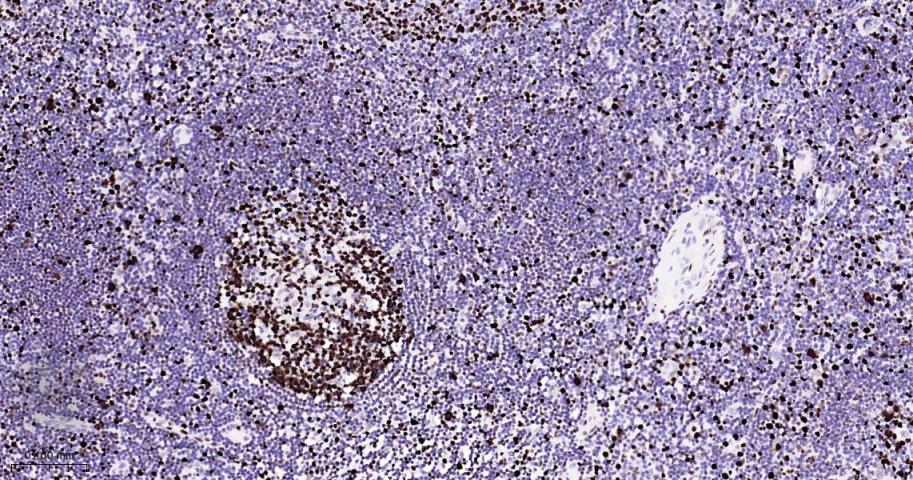 微小染色体维持缺陷蛋白2重组兔单抗