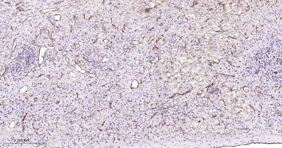 血小板内皮细胞黏附分子1重组兔单抗