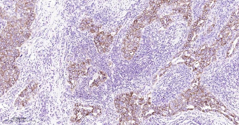 连环蛋白delta-1重组兔单抗