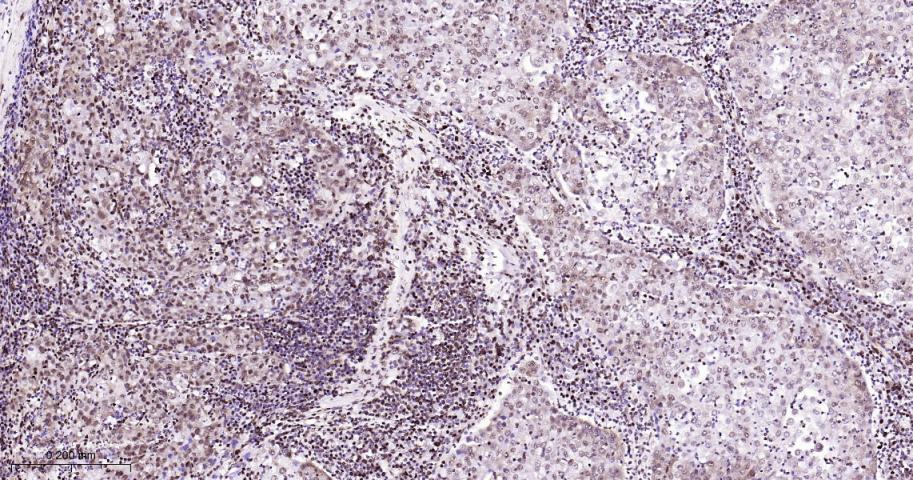 高迁移率族蛋白B1重组兔单抗