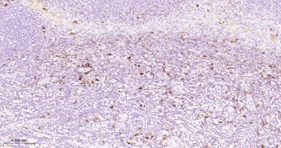 P选择素糖蛋白配体1重组兔单抗