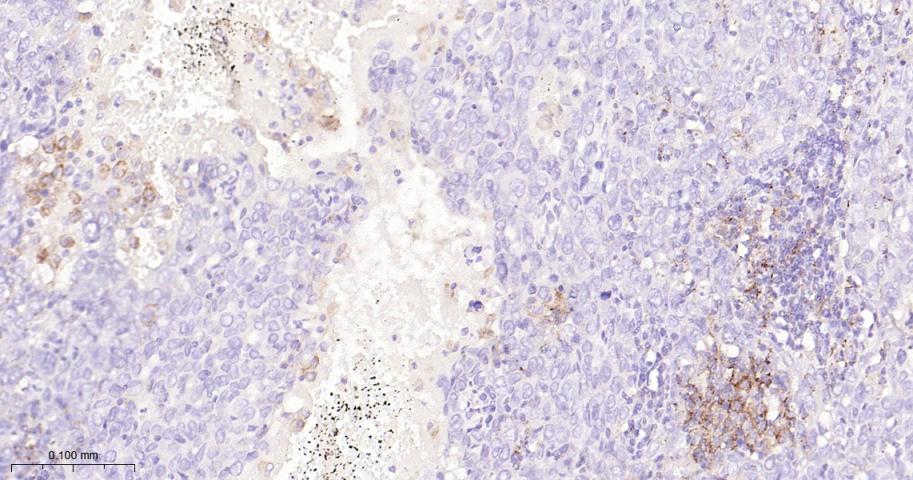 程序性死亡配体1重组兔单抗