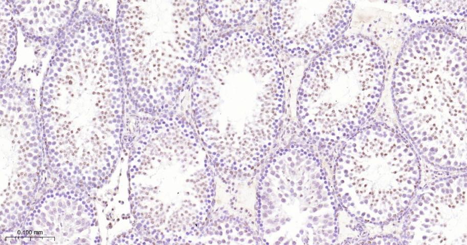 ATP依赖解旋酶SMARCA2重组兔单抗