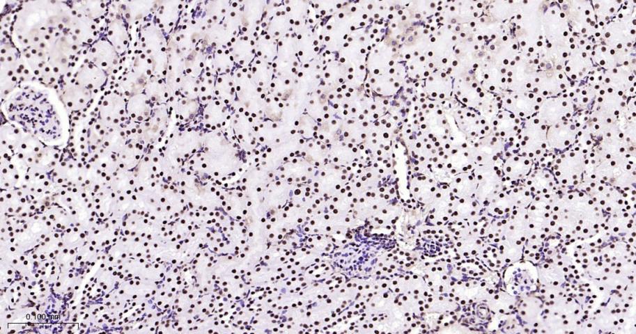 高迁移率族蛋白B1重组兔单抗
