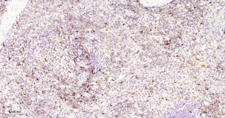 P选择素糖蛋白配体1重组兔单抗