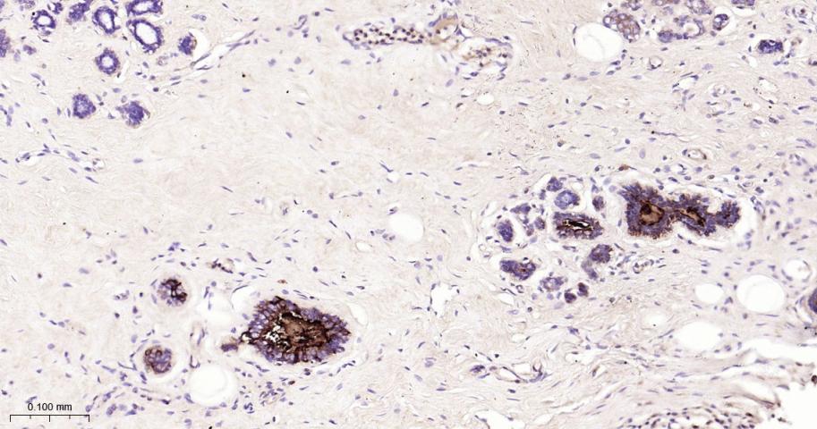 乳腺珠蛋白1重组兔单抗