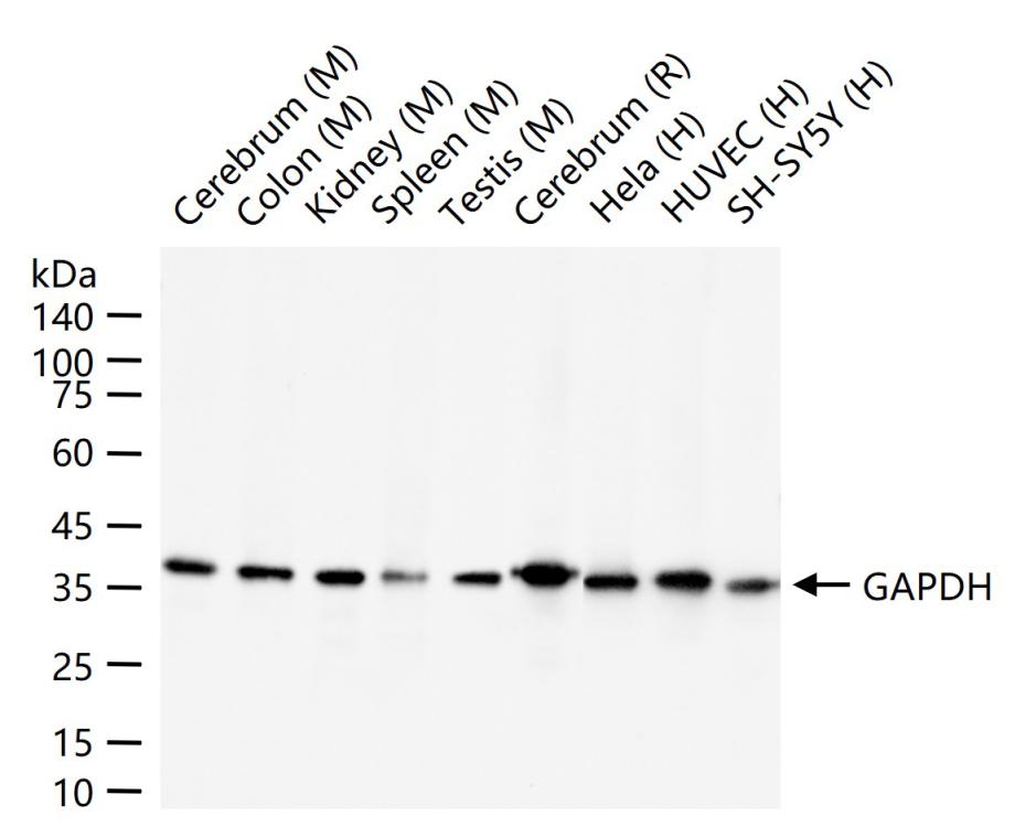 3-磷酸甘油醛脱氢酶(内参)重组兔单抗
