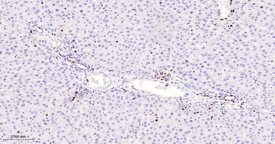 微小染色体维持缺陷蛋白2重组兔单抗