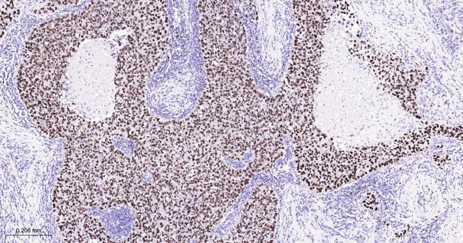 微小染色体维持缺陷蛋白2重组兔单抗
