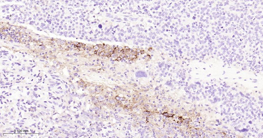 程序性死亡配体1重组兔单抗