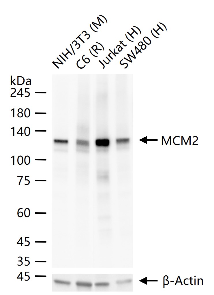 微小染色体维持缺陷蛋白2重组兔单抗