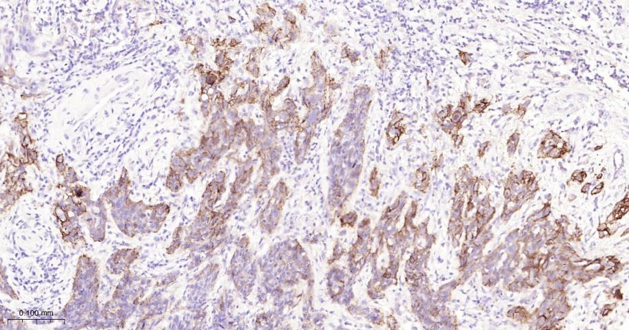 程序性死亡配体1重组兔单抗