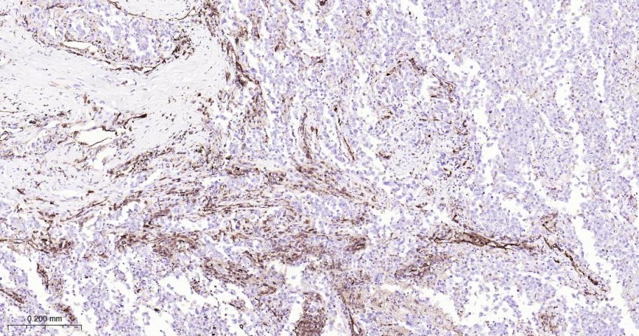 血小板内皮细胞黏附分子1重组兔单抗