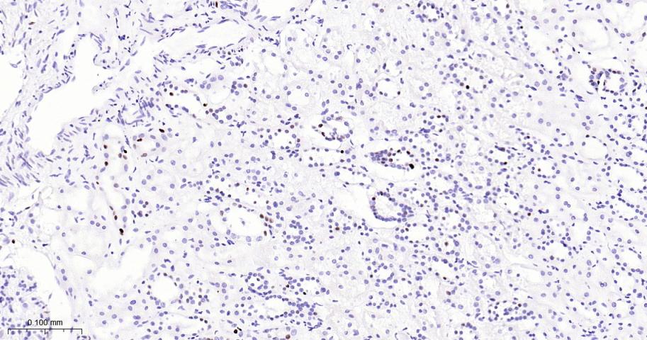 微小染色体维持缺陷蛋白2重组兔单抗