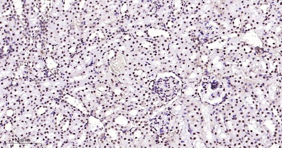 高迁移率族蛋白B1重组兔单抗