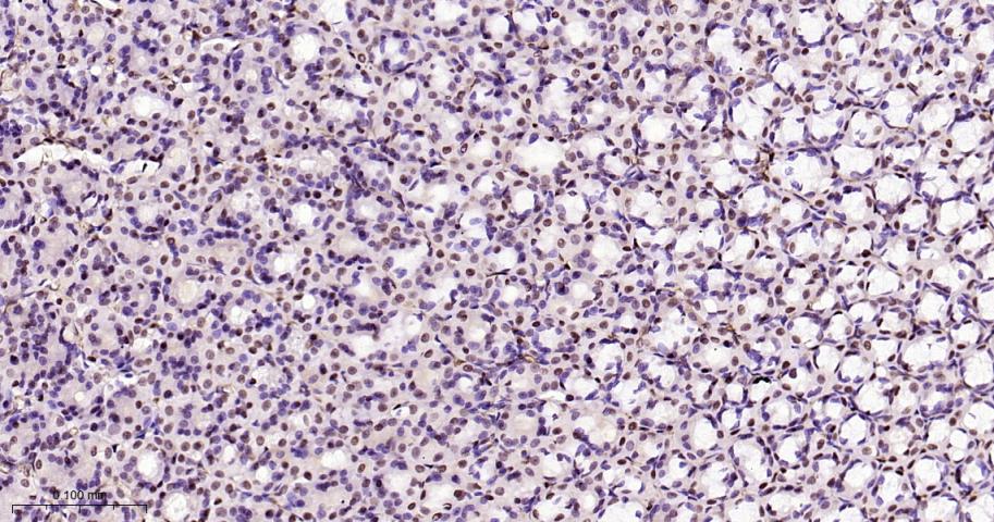 高迁移率族蛋白B1重组兔单抗