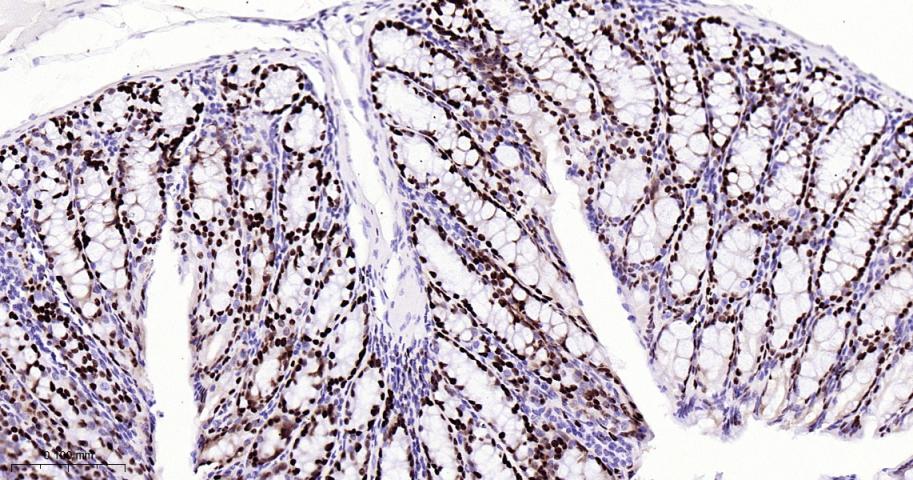 微小染色体维持缺陷蛋白2重组兔单抗