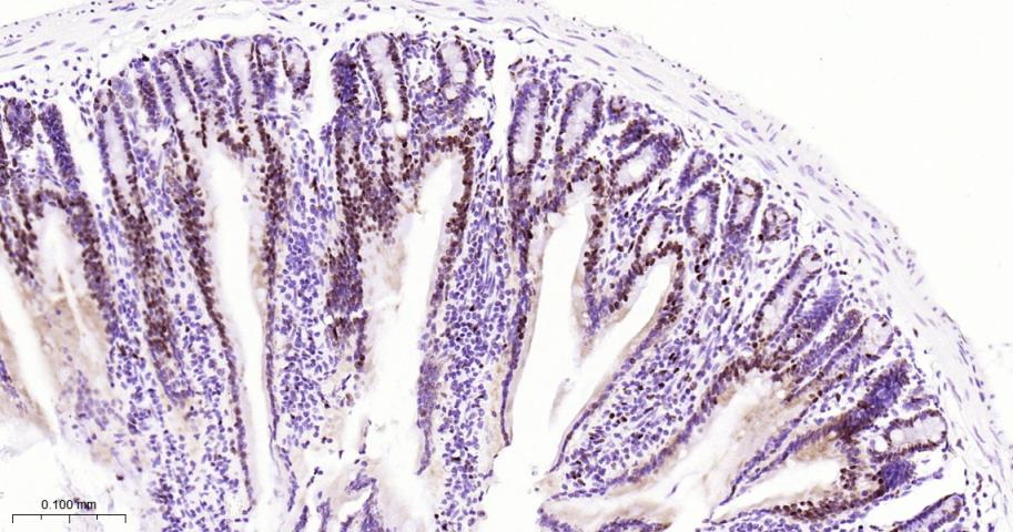 微小染色体维持缺陷蛋白2重组兔单抗