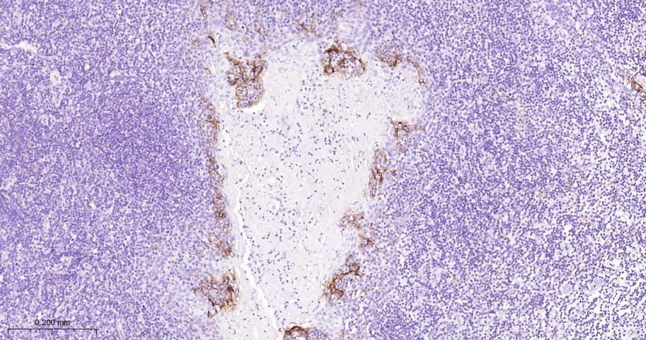 程序性死亡配体1重组兔单抗