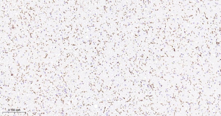 P选择素糖蛋白配体1重组兔单抗