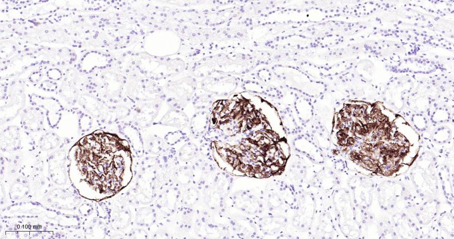Ⅰ型补体受体重组兔单抗