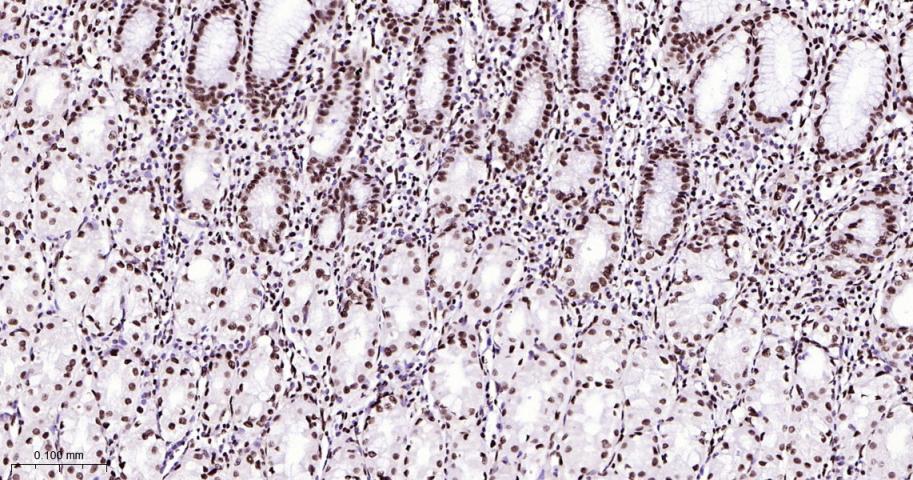 高迁移率族蛋白B1重组兔单抗
