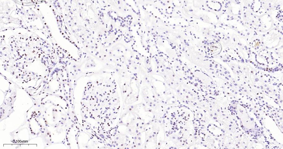ATP依赖解旋酶SMARCA2重组兔单抗