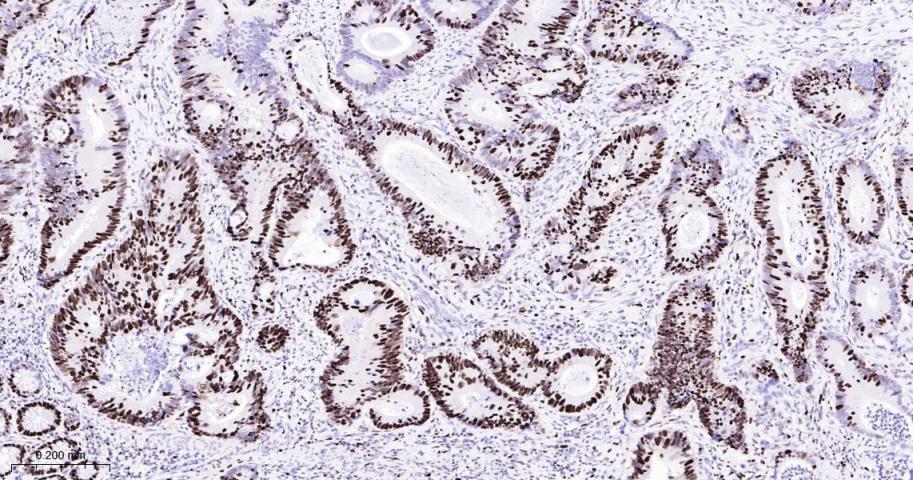 微小染色体维持缺陷蛋白2重组兔单抗
