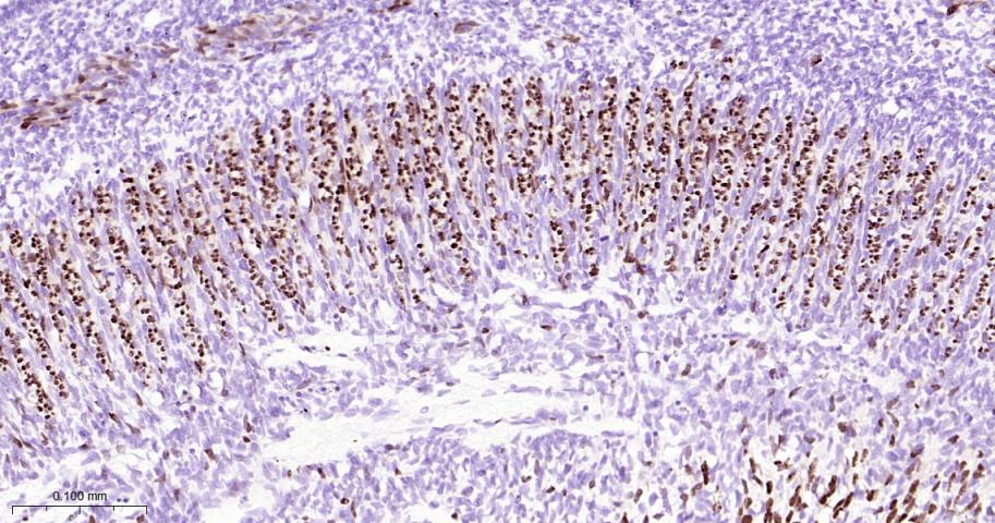肌细胞生成素重组兔单抗