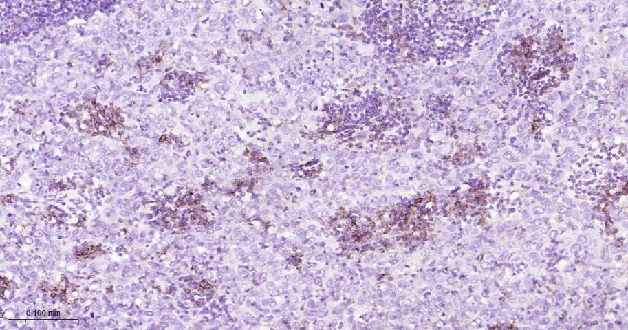 P选择素糖蛋白配体1重组兔单抗