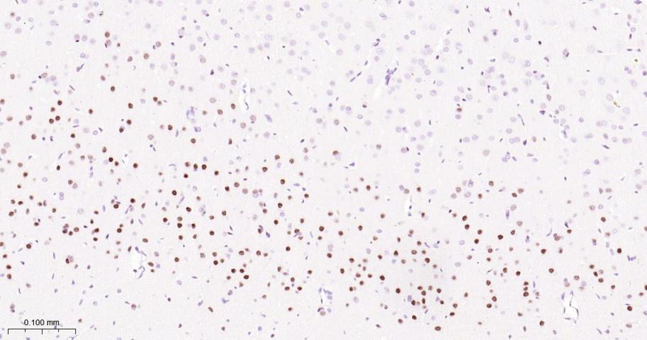 ATP依赖解旋酶SMARCA2重组兔单抗