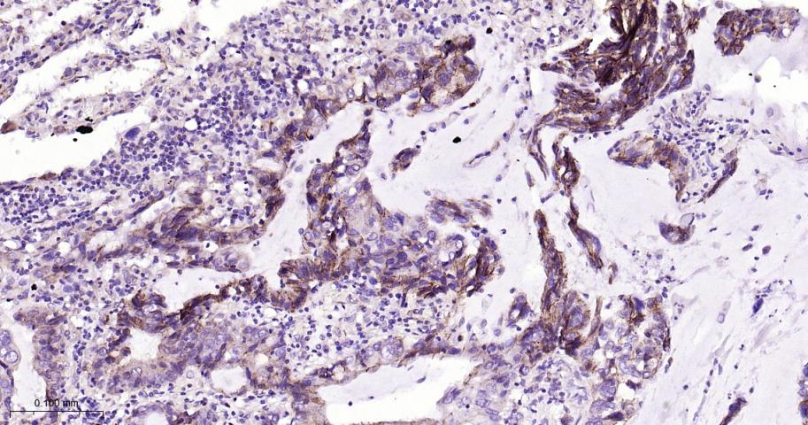 连环蛋白delta-1重组兔单抗