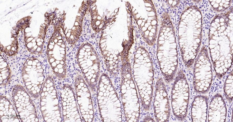 连环蛋白delta-1重组兔单抗