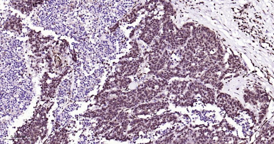 高迁移率族蛋白B1重组兔单抗