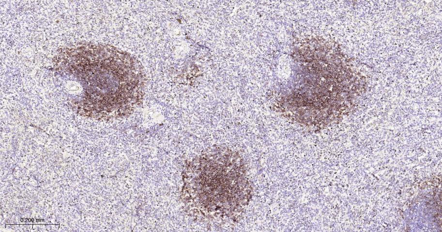 Ⅰ型补体受体重组兔单抗