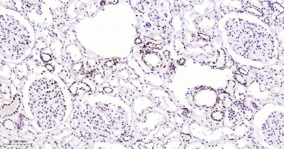 高迁移率族蛋白B1重组兔单抗