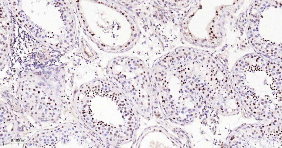 ATP依赖解旋酶SMARCA2重组兔单抗