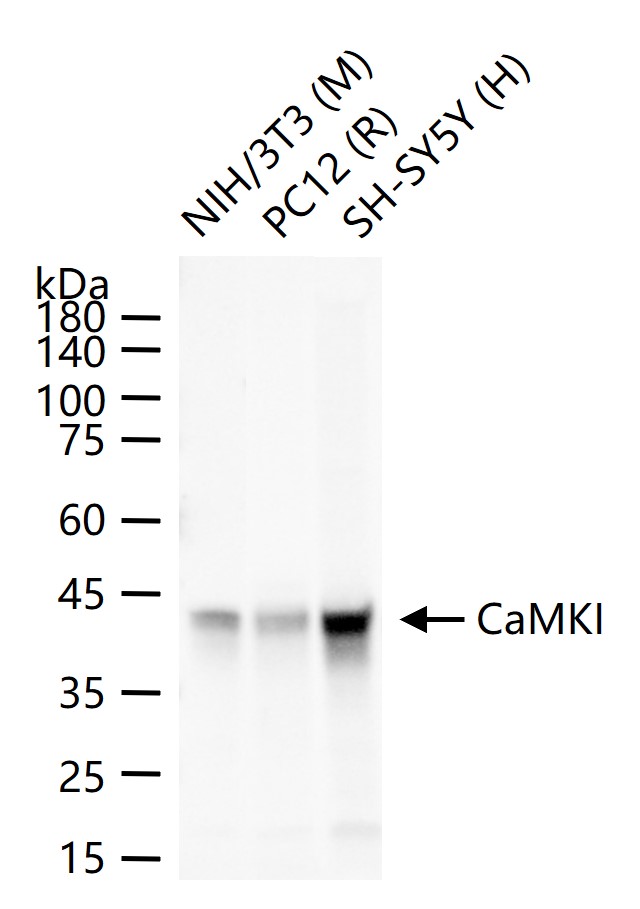 钙/钙调蛋白依赖性蛋白激酶 I重组兔单抗