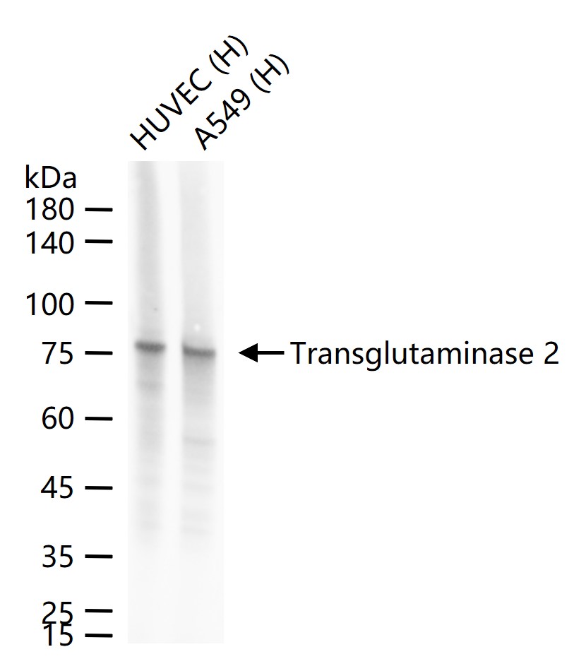 Transglutaminase 2 Recombinant Mouse mAb (一抗) - WB,IHC-P,IHC-F,IF,ICC/IF | Bioss